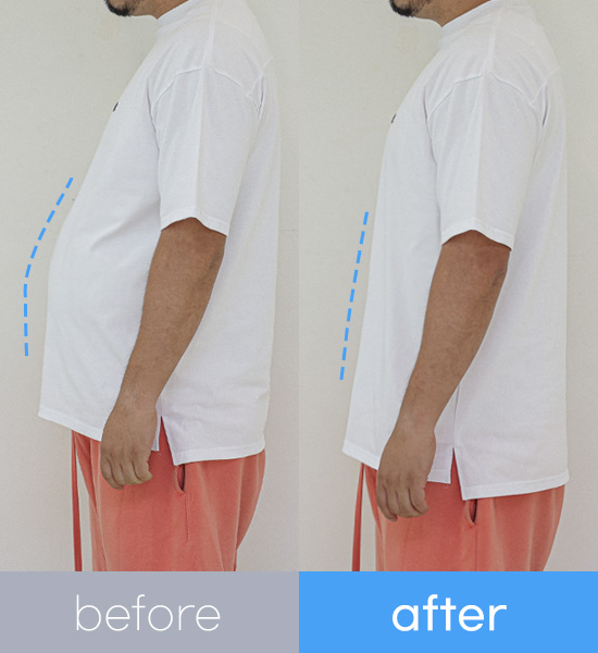 (L-5XL)<BR>마크타퍼 矫正无袖衬衫<br><font color="#fb5ec9"><B>[1+1]</B></font>